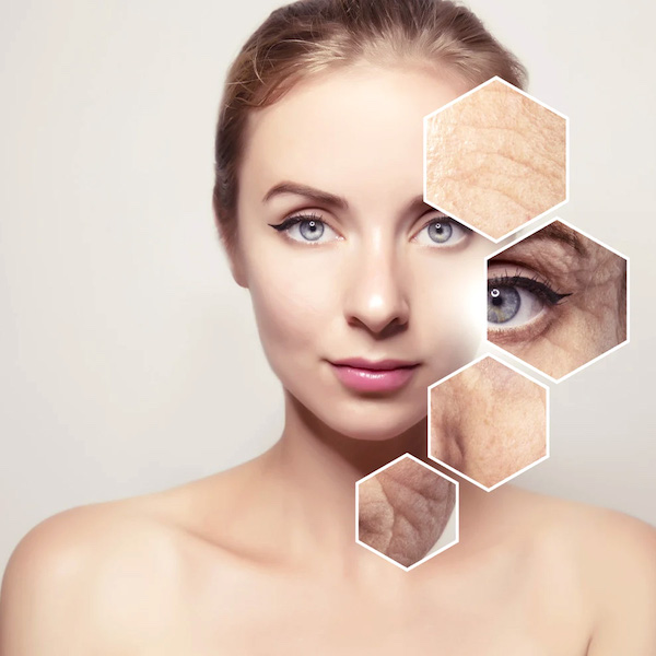 Collagen 2